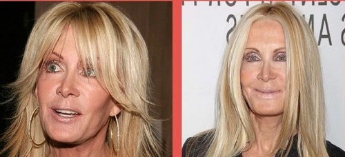 A picture of Joan Van Ark from past (left) and present (right).